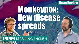 Monkeypox: New disease spreads: BBC News Review