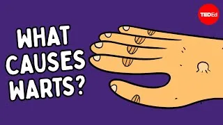 What are warts — and how do you get rid of them? - Cella Wright