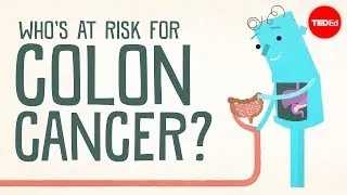 Who's at risk for colon cancer? - Amit H. Sachdev and Frank G. Gress