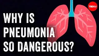 Why is pneumonia so dangerous? - Eve Gaus and Vanessa Ruiz