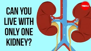 How do kidney transplants work? - Alexander H. Toledo