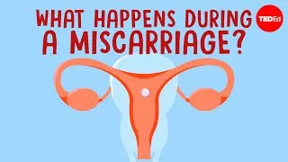 What happens in your body during a miscarriage? - Nassim Assefi and Emily M. Godfrey
