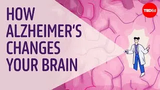 Why is Alzheimer’s disease so difficult to treat? - Krishna Sudhir