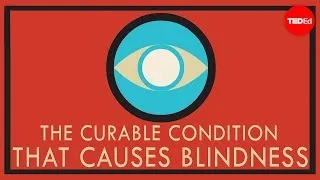 A curable condition that causes blindness - Andrew Bastawrous