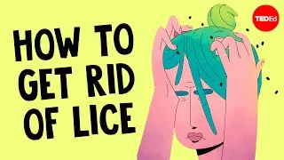 This is the most common way to get head lice - Nazzy Pakpour