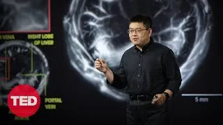 The Incredible Cancer-Detecting Potential of Photoacoustic Imaging | Lei Li | TED