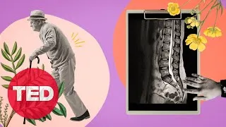5 Things You Should Know About Back Pain | Body Stuff with Dr. Jen Gunter | TED